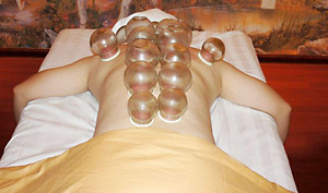 CUPPING